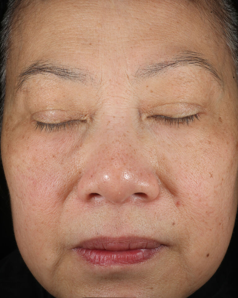 Despu&eacute;s de usar la Loci&oacute;n Facial Regeneradora C + E TimeWise&reg; en el &aacute;rea de las cejas.