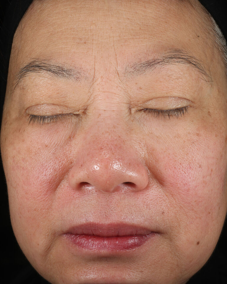 Antes de usar la Loci&oacute;n Facial Regeneradora C + E TimeWise&reg; en el &aacute;rea de las cejas.