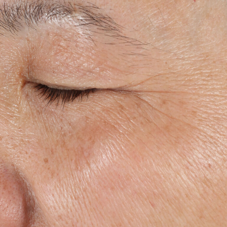 Antes de usar la Loci&oacute;n Facial Regeneradora C + E TimeWise&reg; en el &aacute;rea de los ojos.