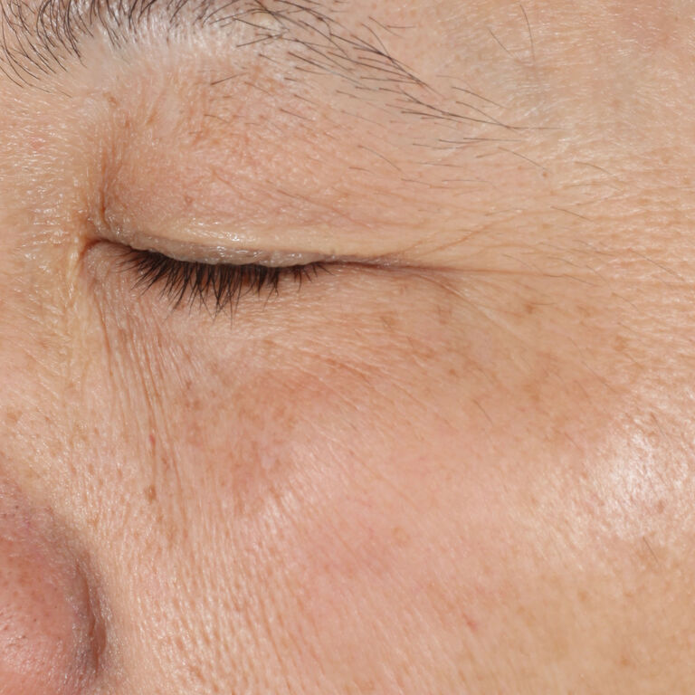 Despu&eacute;s de usar la Loci&oacute;n Facial Regeneradora C + E TimeWise&reg; en el &aacute;rea de los ojos.