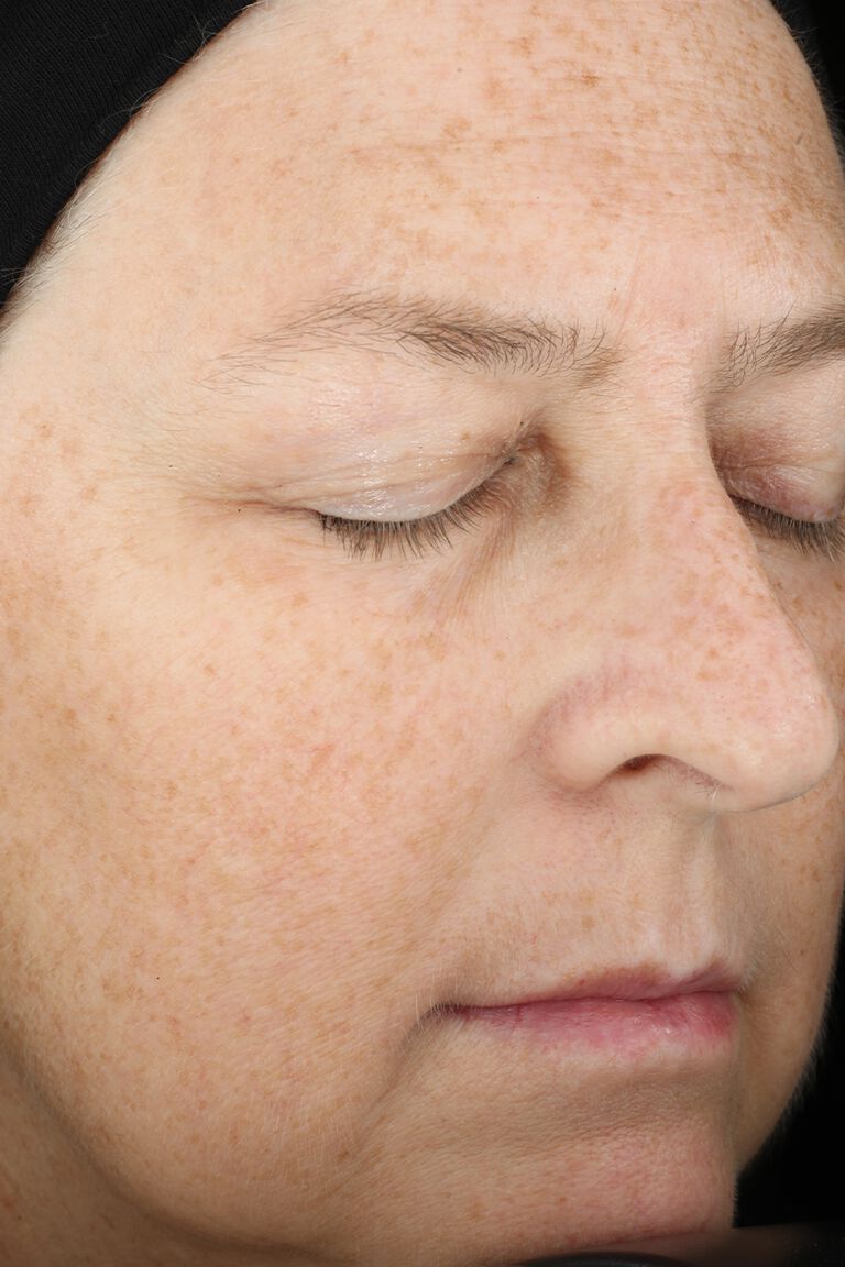 D&iacute;a 1: Antes de aplicar la Combinaci&oacute;n Ideal Avanzada TimeWise&reg; de Mary Kay&reg;