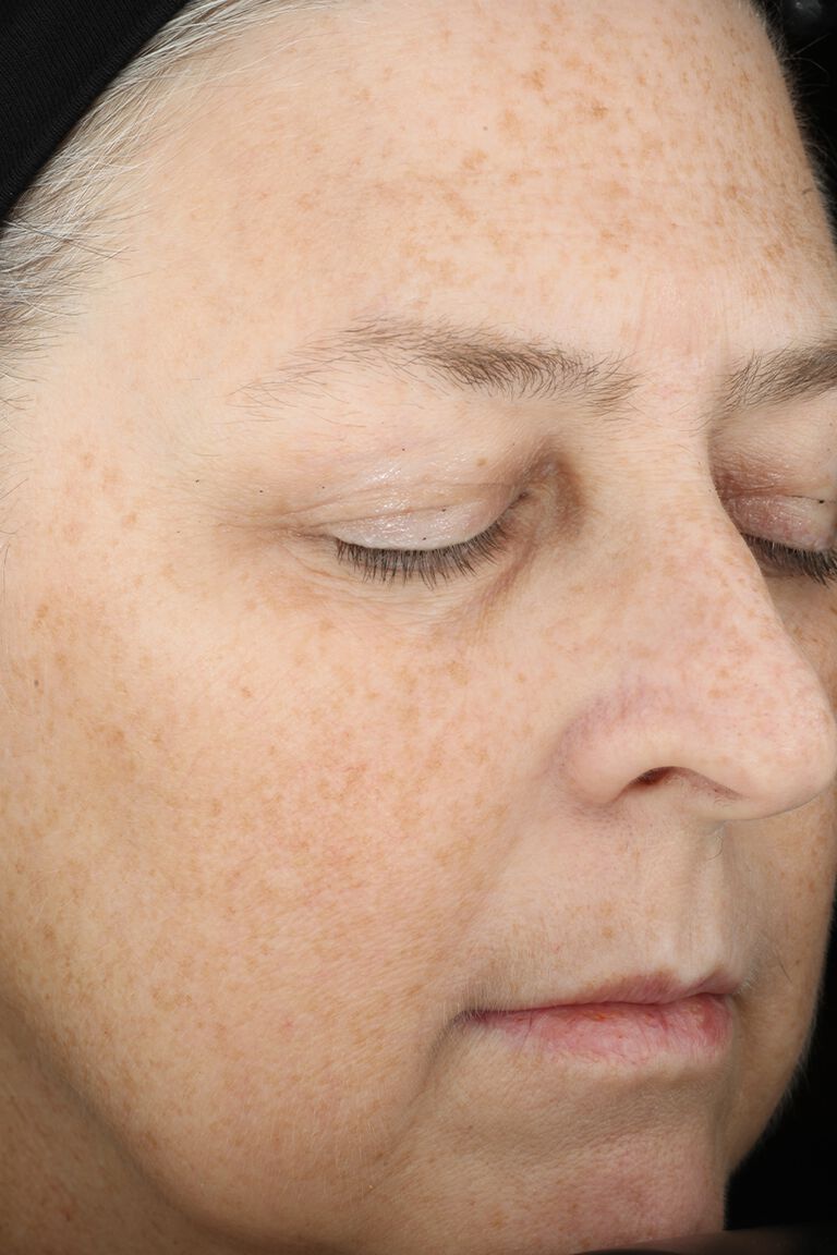 Semana 12: Despu&eacute;s de aplicar la Combinaci&oacute;n Ideal Avanzada TimeWise&reg; de Mary Kay&reg;