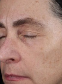 Sujeto C antes de usar  el Suero Facial Retinol 0.3 Mary Kay&reg; Clinical Solutions&reg;